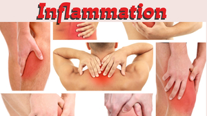 Inflammation